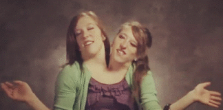 Siamesiska tvillingar med nyfött barn